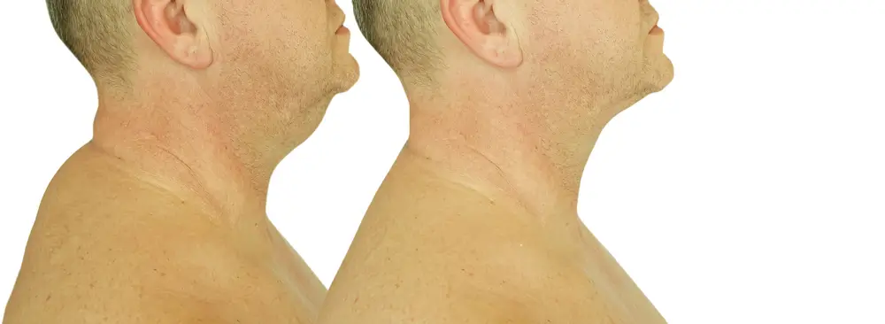 Muž ukazuje zlepšení držení těla po cvičení proti vdovskému hrubu.